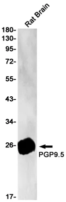 Western blot analysis of PGP9.5 in rat Brain lysates using PGP9.5 antibody.