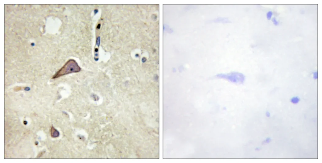 Immunohistochemistry analysis of paraffin-embedded human brain, using NMDAR1 (Phospho-Ser896) Antibody. The picture on the right is blocked with the phospho peptide.