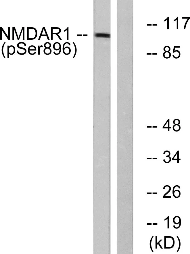 Western blot analysis of lysates from K562 cells treated with PMA 125ng/ml 30', using NMDAR1 (Phospho-Ser896) Antibody. The lane on the right is blocked with the phospho peptide.
