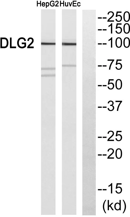 Western blot analysis of DLG2 Antibody. The lane on the right is blocked with the DLG2 peptide.