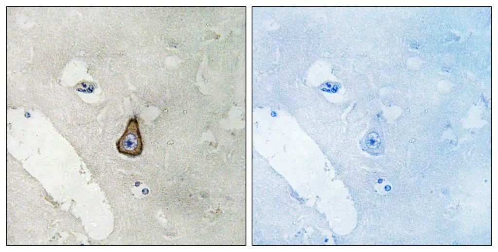 Immunohistochemistryt analysis of paraffin-embedded human brain, using DLG2 Antibody. The lane on the right is blocked with the DLG2 peptide.