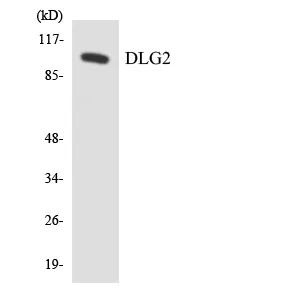 Western blot analysis of the lysates from HeLa cells using DLG2 antibody.