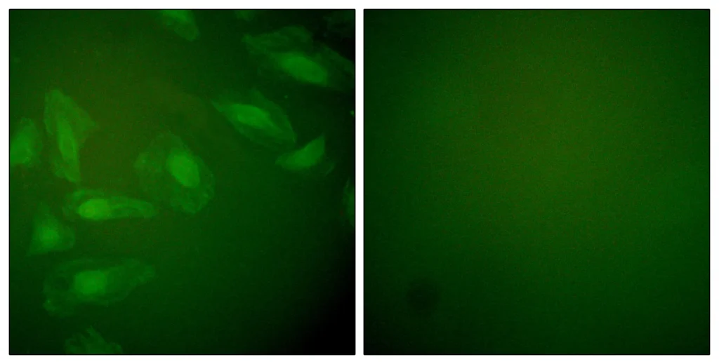 Immunofluorescence analysis of HeLa cells, using DJ-1 Antibody. The picture on the right is blocked with the synthesized peptide.