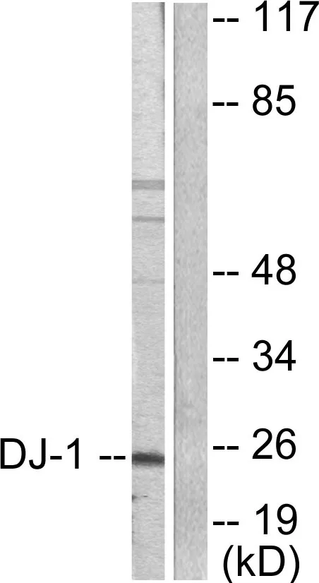 Western blot analysis of lysates from HUVEC cells, using DJ-1 Antibody. The lane on the right is blocked with the synthesized peptide.