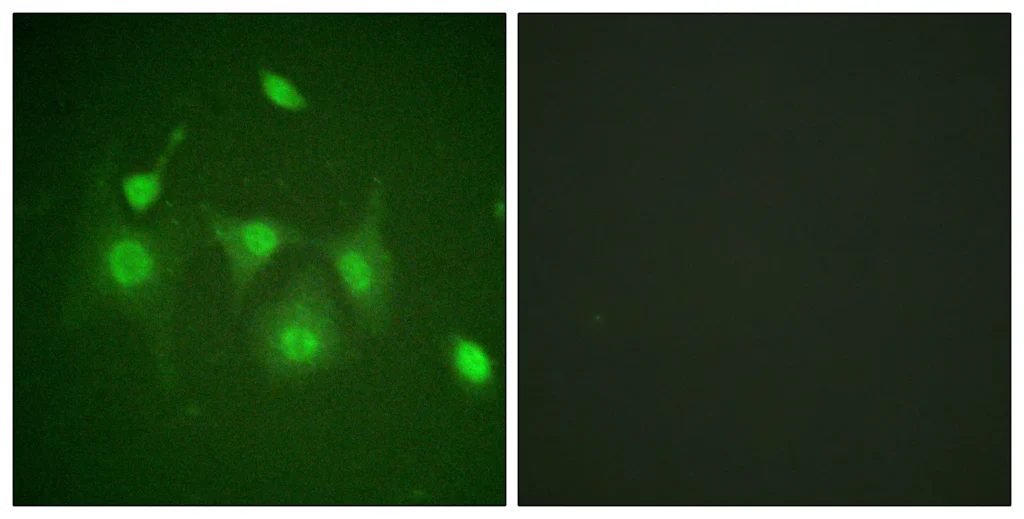 Immunofluorescence analysis of HepG2 cells, using HDAC6 Antibody. The picture on the right is blocked with the synthesized peptide.