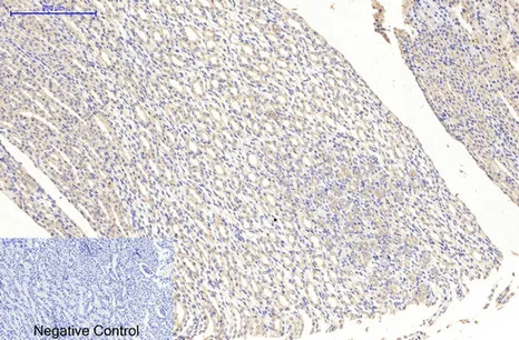 Immunohistochemical analysis of paraffin-embedded Human tonsils using MAP2 (3B5) antibody. High-pressure and temperature Sodium Citrate pH 6.0 was used for antigen retrieval. Negative control was used by secondary antibody only.