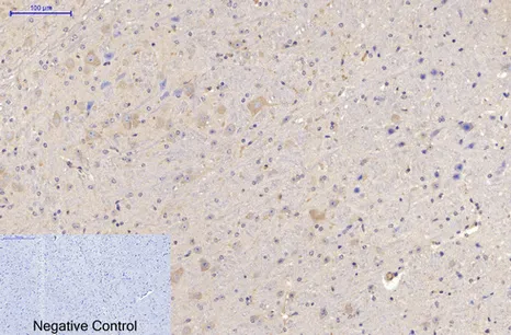 Immunohistochemistry analysis of paraffin-embedded mouse brain tissue using MAP2 antibody. High-pressure and temperature Sodium Citrate pH 6.0 was used for antigen retrieval. Negative control was used by secondary antibody only.