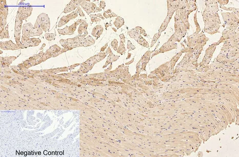 Immunohistochemical analysis of paraffin-embedded Rat-heart tissue. 1,GFAP Monoclonal Antibody（5C8） was diluted at 1:200（4°C,overnight）. 2, Sodium citrate pH 6.0 was used for antibody retrieval（>98°C,20min）. 3,Secondary antibody was diluted at 1:200（room tempeRature, 30min）. Negative control was used by secondary antibody only.
