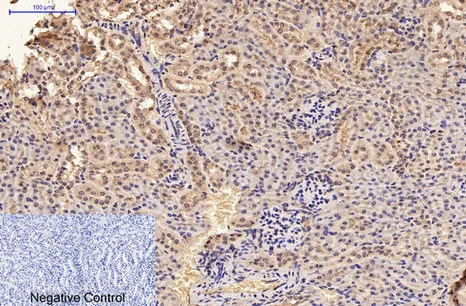 Immunohistochemical analysis of paraffin-embedded Mouse-kidney tissue. 1,GFAP Monoclonal Antibody（5C8） was diluted at 1:200（4°C,overnight）. 2, Sodium citrate pH 6.0 was used for antibody retrieval（>98°C,20min）. 3,Secondary antibody was diluted at 1:200（room tempeRature, 30min）. Negative control was used by secondary antibody only.