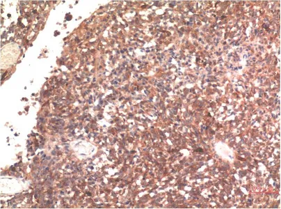 Immunohistochemical analysis of paraffin-embedded Human Brain Tissue using Tau Mouse mAb diluted at 1:200