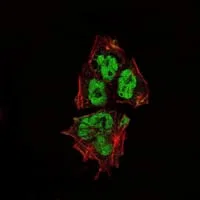 Immunofluorescence analysis of NTERA-2 cells using SOX2 mouse mAb (green). Red: Actin filaments have been labeled with Alexa Fluor-555 phalloidin.