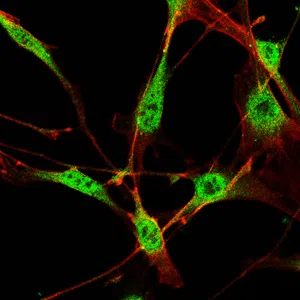 Immunofluorescence analysis of NIH3T3 cells using SOX2 mouse mAb (green). Red: Actin filaments have been labeled with Alexa Fluor-555 phalloidin.