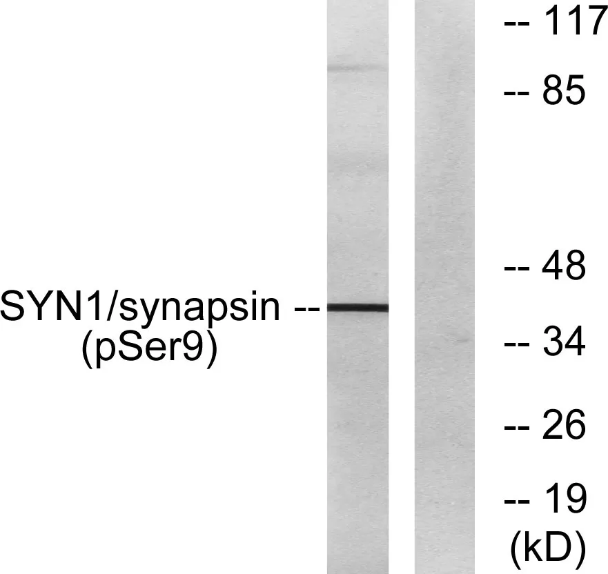 Western blot analysis of lysates from 293 cells treated with PMA 200nM 30', using Synapsin (Phospho-Ser9) Antibody. The lane on the right is blocked with the phospho peptide.