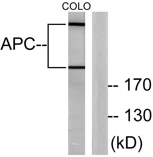 Western blot analysis of lysates from COLO205 cells, using APC Antibody. The lane on the right is blocked with the synthesized peptide.