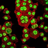 Immunofluorescence analysis of HepG2 cells using OTX2 mouse mAb (green). Red: Actin filaments have been labeled with Alexa Fluor-555 phalloidin.