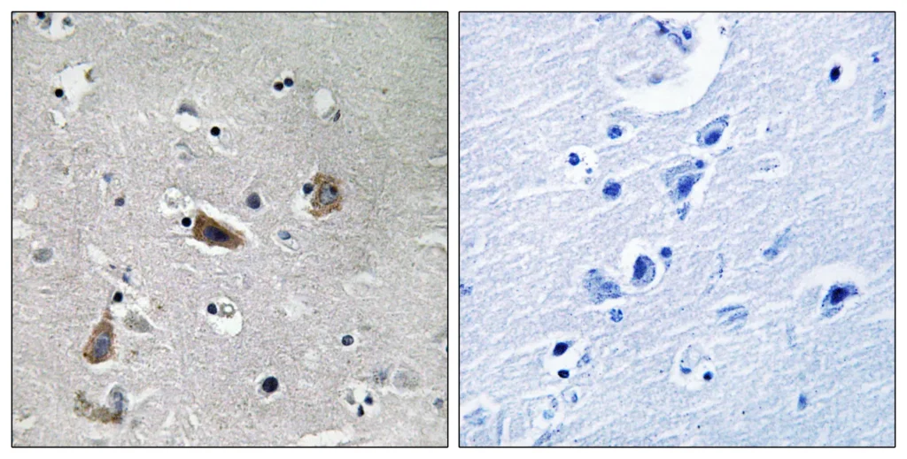 Immunohistochemistry analysis of paraffin-embedded human brain, using Doublecortin (Phospho-Ser376) Antibody. The picture on the right is blocked with the phospho peptide.