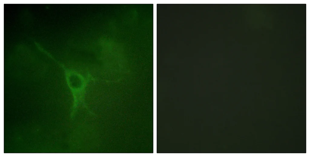 Immunofluorescence analysis of COS7 cells, using GFAP (Phospho-Ser38) Antibody. The picture on the right is blocked with the phospho peptide.