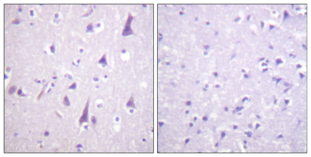 Immunohistochemistry analysis of paraffin-embedded human brain, using GFAP (Phospho-Ser38) Antibody. The picture on the right is blocked with the phospho peptide.