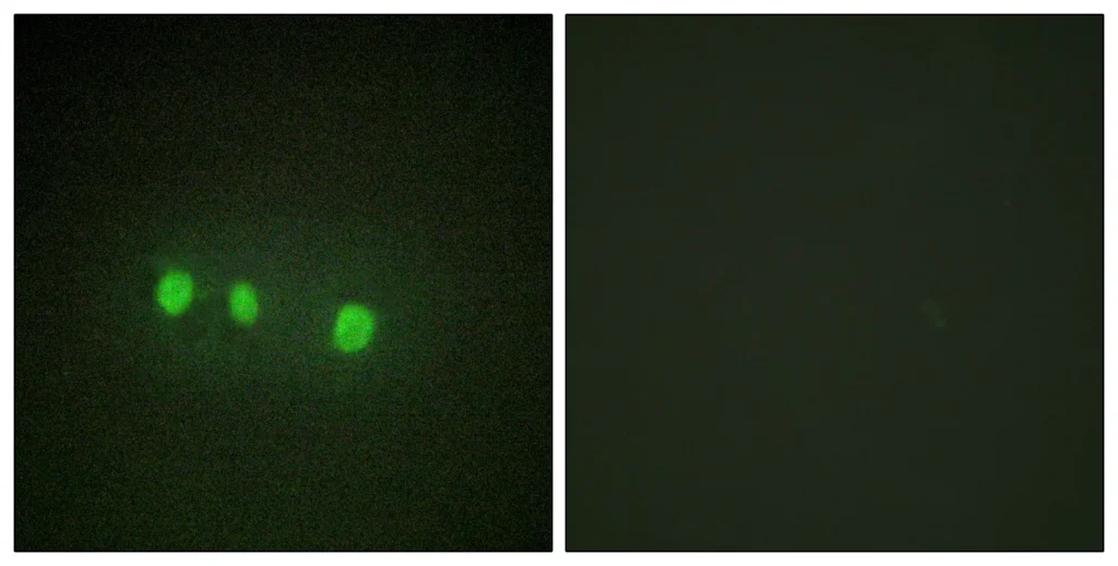 Immunofluorescence analysis of HepG2 cells, using ZIC1/2/3/4/5 Antibody. The picture on the right is blocked with the synthesized peptide.