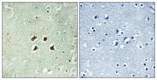 Immunohistochemical analysis of paraffin-embedded Human brain. Antibody was diluted at 1:100（4°,overnight）. High-pressure and temperature Tris-EDTA,pH8.0 was used for antigen retrieval. Negetive contrl （right） obtaned from antibody was pre-absorbed by immunogen peptide.