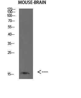 Western blot analysis of HEPG2 293T SHY5Y Jurkat lysate, antibody was diluted at 500. Secondary antibody was diluted at 1:20000