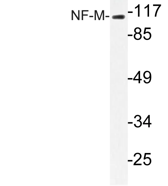 Western blot analysis of lysate from MCF-7 cells, using NF-M antibody.