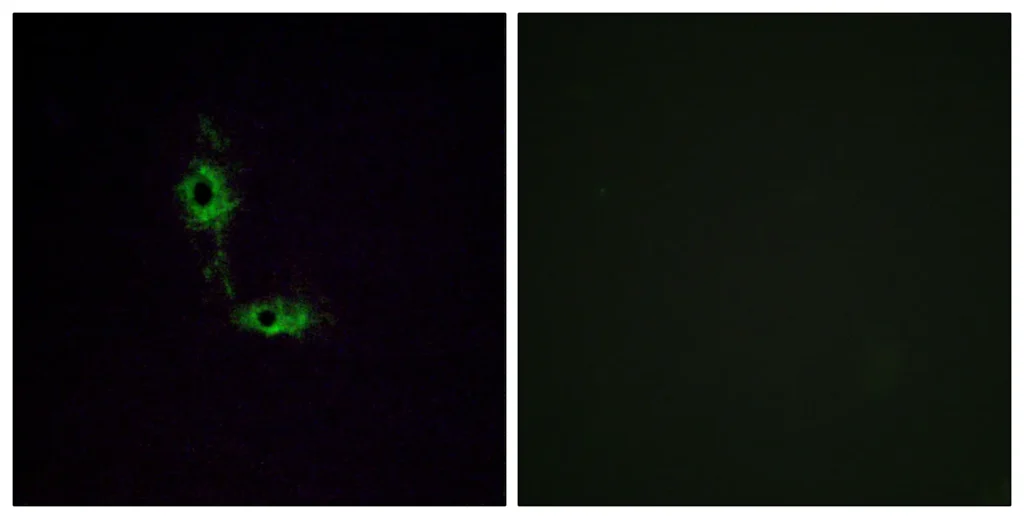 Immunofluorescence analysis of HeLa cells, using GluR1 Antibody. The picture on the right is blocked with the synthesized peptide.
