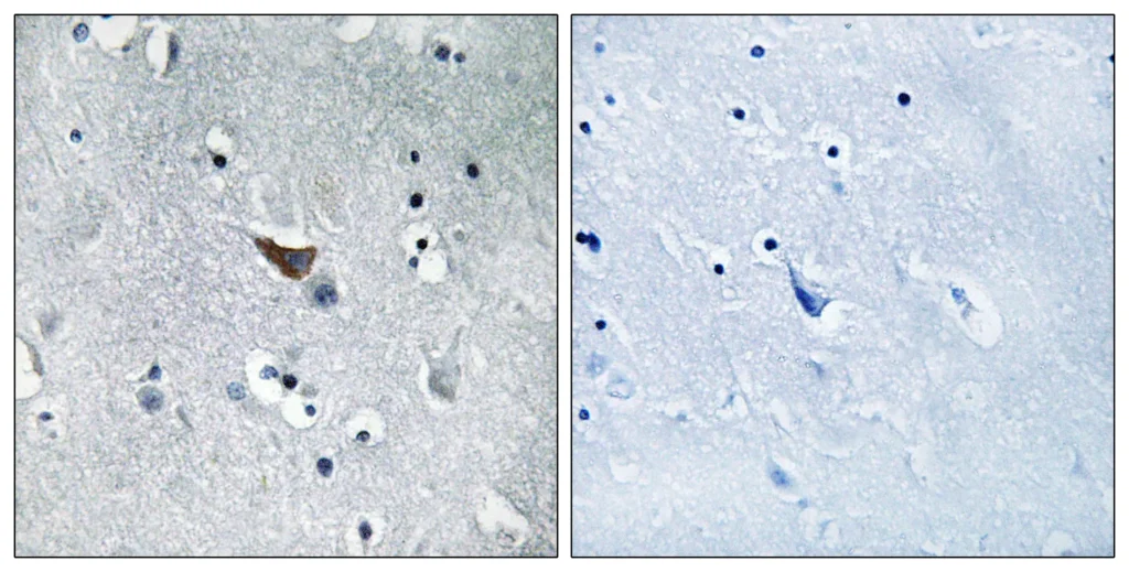 Immunohistochemistry analysis of paraffin-embedded human brain tissue, using GluR1 Antibody. The picture on the right is blocked with the synthesized peptide.