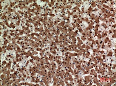 Immunohistochemical analysis of paraffin-embedded human-liver, antibody was diluted at 1:100