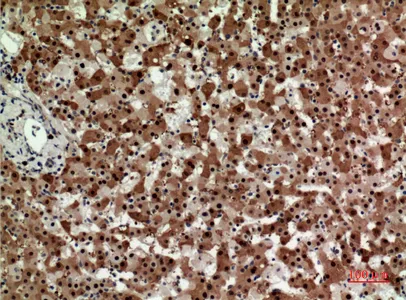 Immunohistochemical analysis of paraffin-embedded human-liver, antibody was diluted at 1:100