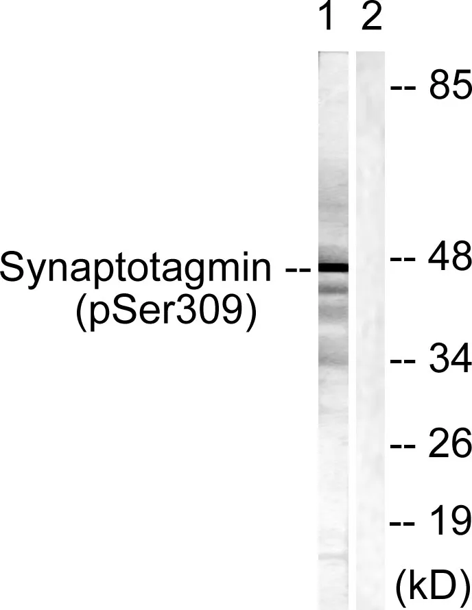 Western blot analysis of lysates from 293 cells treated with Sobital 0.4M 30', using Synaptotagmin （Phospho-Ser309） Antibody. The lane on the right is blocked with the phospho peptide.