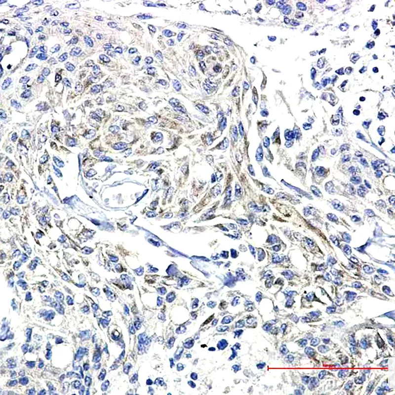 Immunohistochemistry analysis of paraffin-embedded Human Brain using Synapsin I (Phospho- S9) antibody.High-pressure and temperature Sodium Citrate pH 6.0 was used for antigen retrieval.