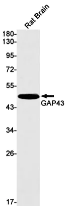 Western blot analysis of GAP43 in rat Brain lysates using GAP43 antibody.
