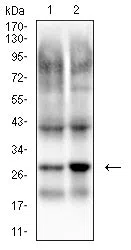 Western blot analysis using UCHL1 mouse mAb against mouse brain (1), and rat brain (2) cell lysate.