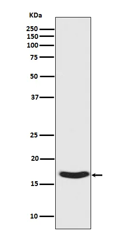 Western blot analysis of Synuclein phosphorylation expression in Human fetal brain lysate.