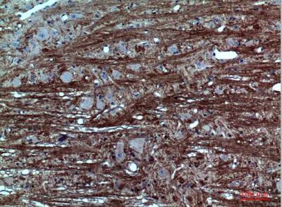 Immunohistochemical analysis of paraffin-embedded rat-brain, antibody was diluted at 1:100