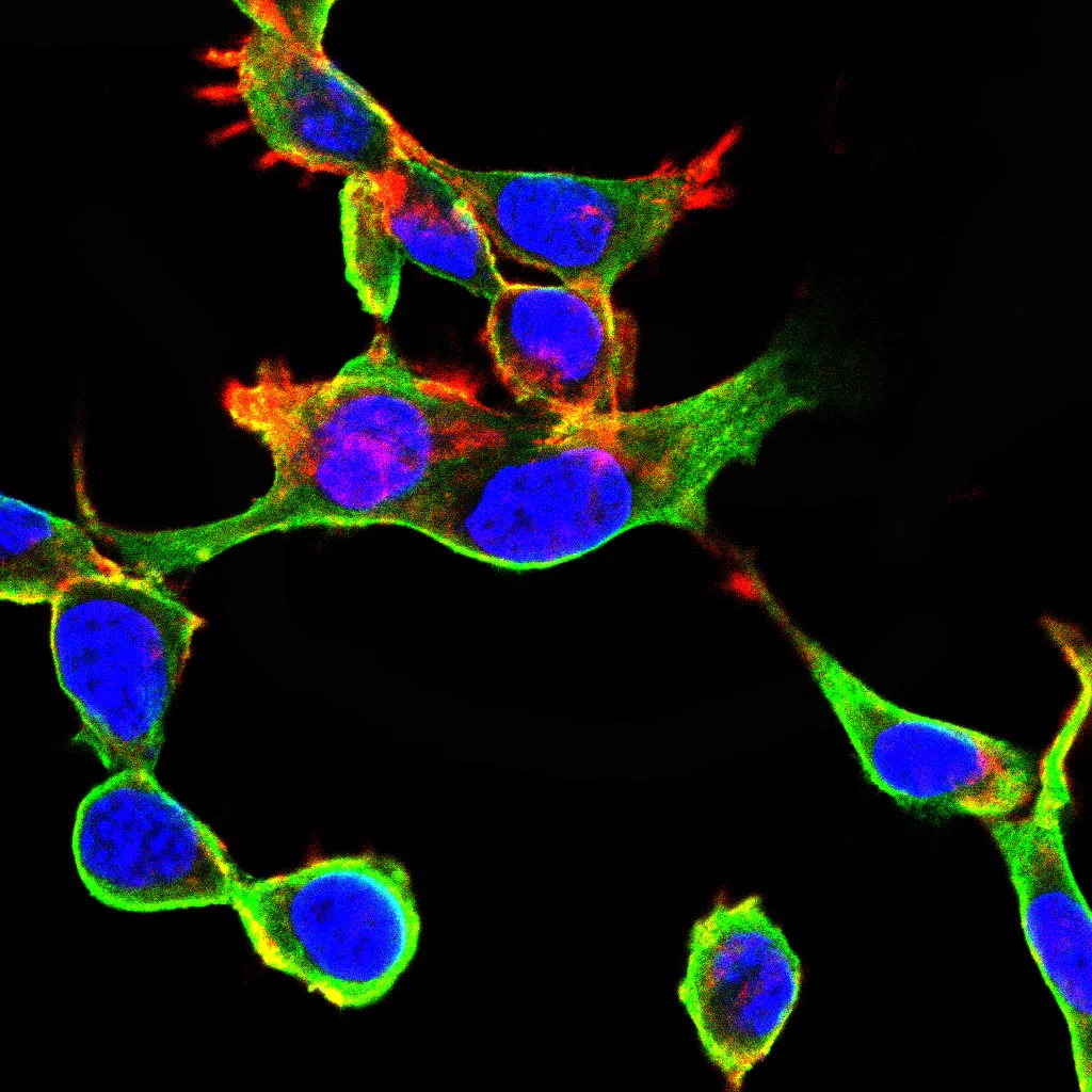 Immunofluorescence analysis of NIH/3T3 cells using PDGFRA mouse mAb (green). Blue: DRAQ5 fluorescent DNA dye. Red: Actin filaments have been labeled with Alexa Fluor- 555 phalloidin.