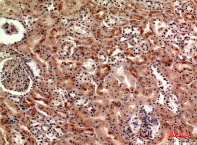 Immunohistochemical analysis of paraffin-embedded human-kidney, antibody was diluted at 1:100