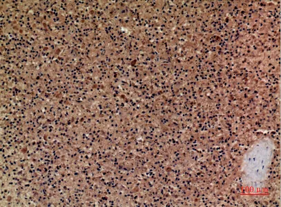 Immunohistochemical analysis of paraffin-embedded human-spleen, antibody was diluted at 1:100