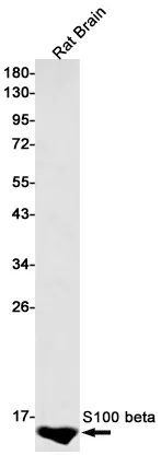 Western blot analysis of S100 beta in rat Brain lysates using S100 beta antibody.