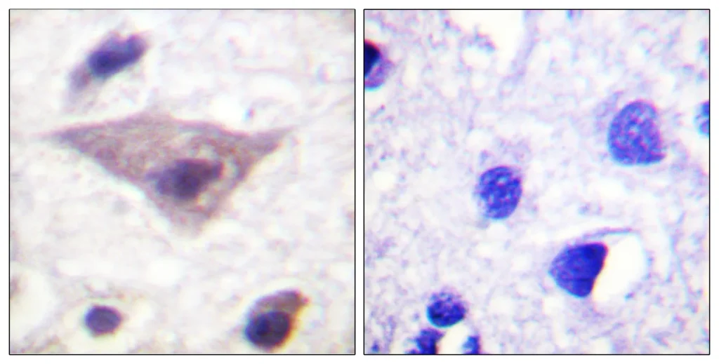 Immunohistochemistry analysis of paraffin-embedded Human brain using Synuclein (Phospho-Ser129) antibody. High-pressure and temperature Sodium Citrate pH 6.0 was used for antigen retrieval. Sample with blocking peptide on the right.
