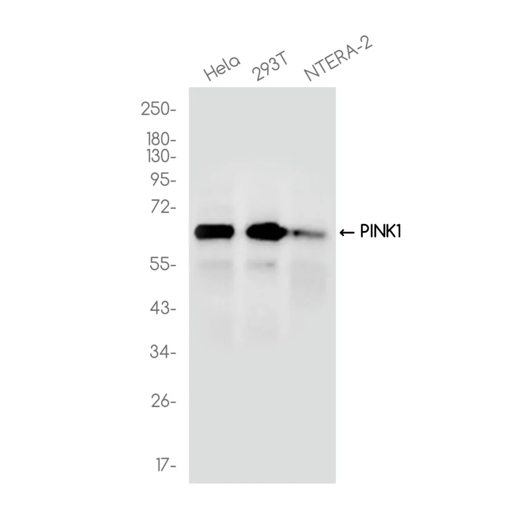 Western blot analysis of PINK1 in various cell lines lysates using PINK1 antibody.