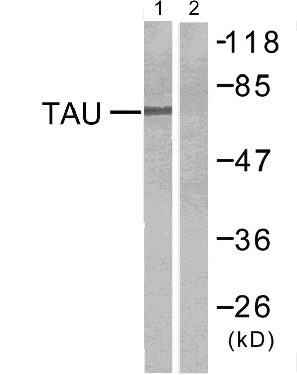 Western blot analysis of Tau in mouse brain using Tau antibody. The lane on the right is blocked with the synthesized peptide.