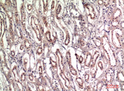 Immunohistochemistry analysis of paraffin-embedded Human kidney using Tenascin antibody. High-pressure and temperature Sodium Citrate pH 6.0 was used for antigen retrieval.