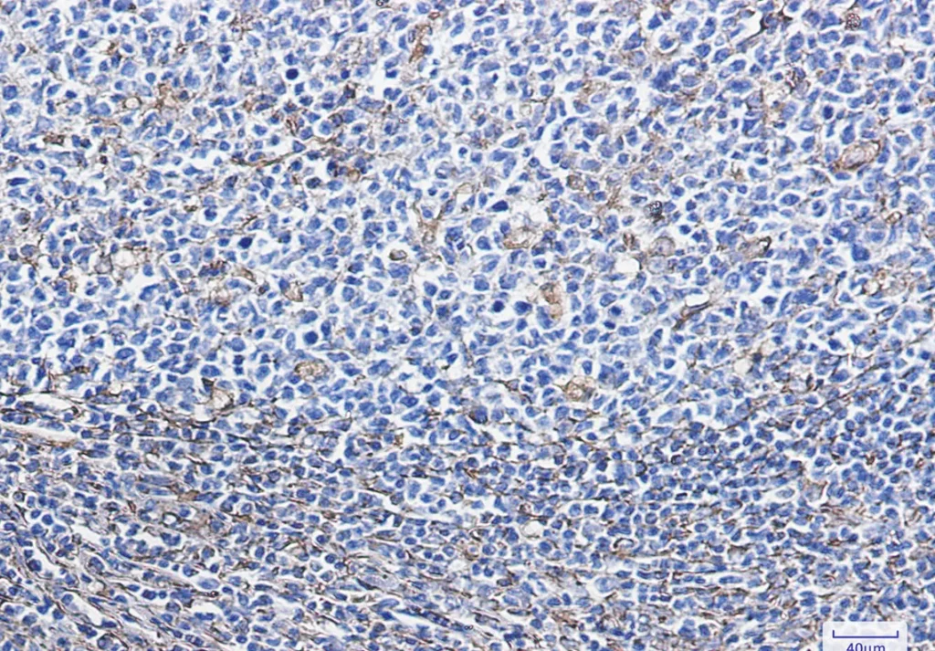 Immunohistochemistry analysis of paraffin-embedded Human tonsil using Vimentin antibody. High-pressure and temperature Sodium Citrate pH 6.0 was used for antigen retrieval.