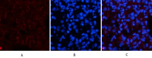 Immunofluorescence analysis of rat-lung tissue. 1,Amyloid-β Polyclonal Antibody（red） was diluted at 1:200（4°C,overnight）. 2, Cy3 labled Secondary antibody was diluted at 1:300（room temperature, 50min）.3, Picture B: DAPI（blue） 10min. Picture A:Target. Picture B: DAPI. Picture C: merge of A+B