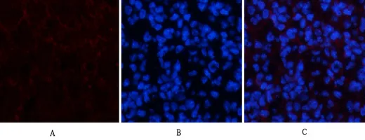 Immunofluorescence analysis of mouse-spleen tissue. 1,Amyloid-β Polyclonal Antibody（red） was diluted at 1:200（4°C,overnight）. 2, Cy3 labled Secondary antibody was diluted at 1:300（room temperature, 50min）.3, Picture B: DAPI（blue） 10min. Picture A:Target. Picture B: DAPI. Picture C: merge of A+B