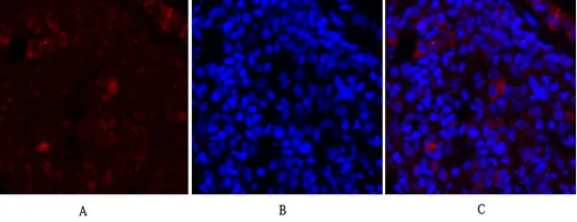 Immunofluorescence analysis of rat-lung tissue. 1,Synapsin I Polyclonal Antibody（red） was diluted at 1:200（4°C,overnight）. 2, Cy3 labled Secondary antibody was diluted at 1:300（room temperature, 50min）.3, Picture B: DAPI（blue） 10min. Picture A:Target. Picture B: DAPI. Picture C: merge of A+B