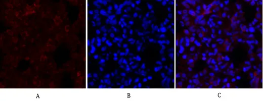 Immunofluorescence analysis of rat-lung tissue. 1,Synapsin I Polyclonal Antibody（red） was diluted at 1:200（4°C,overnight）. 2, Cy3 labled Secondary antibody was diluted at 1:300（room temperature, 50min）.3, Picture B: DAPI（blue） 10min. Picture A:Target. Picture B: DAPI. Picture C: merge of A+B