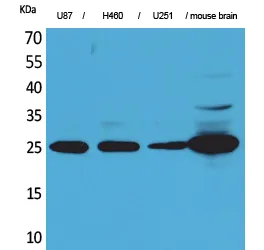 Western Blot analysis of U87, H460, U251, mouse brain cells using UCH-L1 Polyclonal Antibody.. Secondary antibody was diluted at 1:20000
